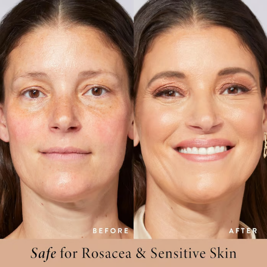 BB crème hydratante SPF 30 - éclaircit, hydrate et unifie votre peau