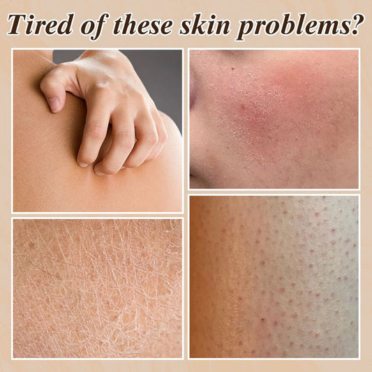 Lotion Corporelle Nourrissante Hydratante en Spray