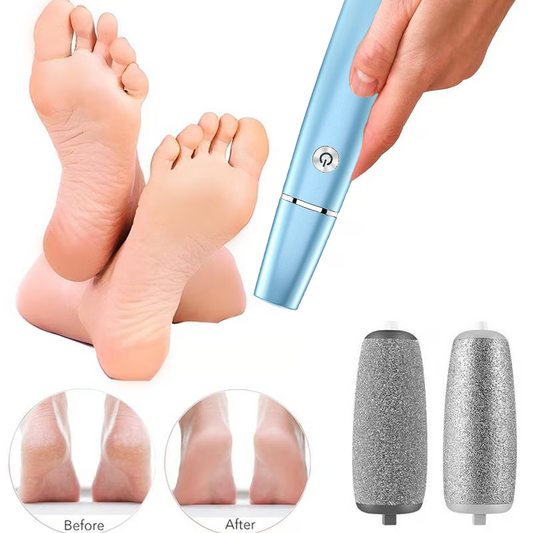 💥Offre à durée limitée 50 % RÉDUCTION⚡Extracteur de callosités électrique pour les pieds