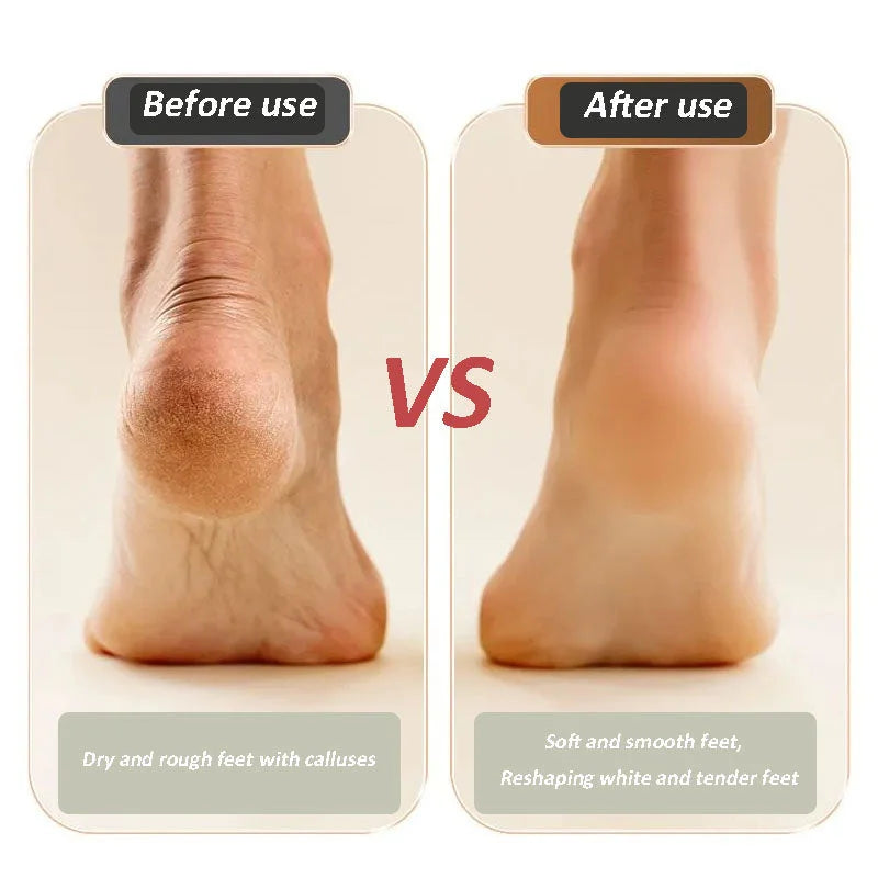 🔥 2025 nouvelle pédicure et meuleuse de pieds rechargeables par USB