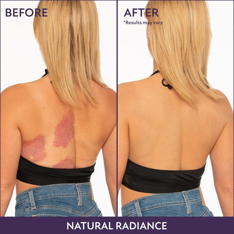 🔥VENTE DU DERNIER JOUR 50% DE RÉDUCTION !✨Body Coverage Perfector - Maquillage corporel imperméable, léger et impeccable