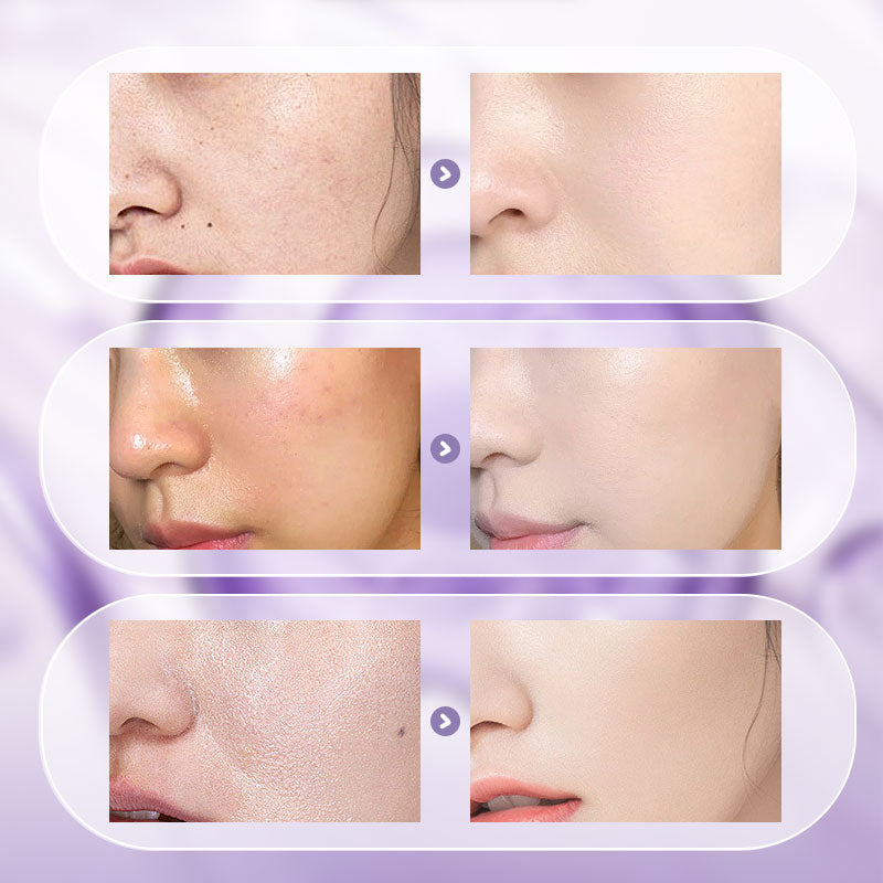 🔆⚡🔆Naturellement, tu étais belle🎉 Vente chaude d'été 🎉 Crème Niacinamide tout-en-un