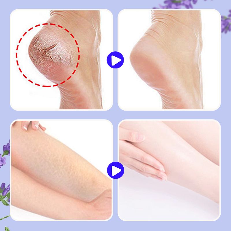 Baume nourrissant réparateur pour les pieds anti-crevasses👣💙