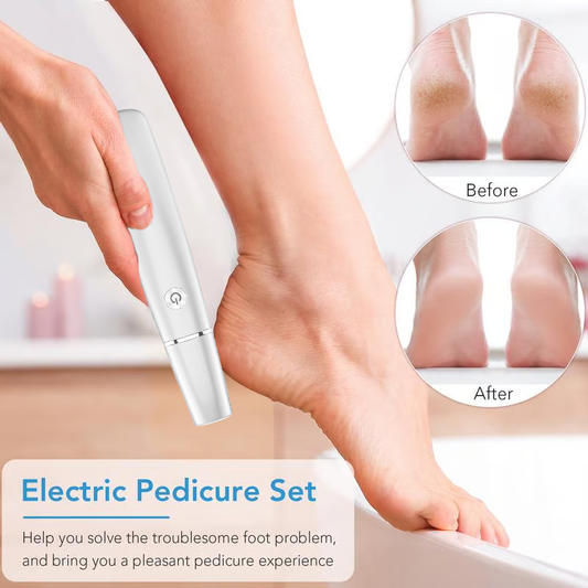 💥Offre à durée limitée 50 % RÉDUCTION⚡Extracteur de callosités électrique pour les pieds