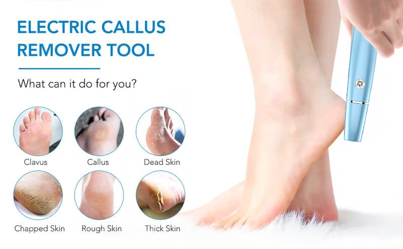 💥Offre à durée limitée 50 % RÉDUCTION⚡Extracteur de callosités électrique pour les pieds