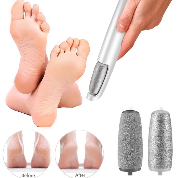 💥Offre à durée limitée 50 % RÉDUCTION⚡Extracteur de callosités électrique pour les pieds