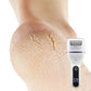 🏆50% de réduction pour une durée limitée✨🌸Extracteur de callosités électrique portatif pour les pieds