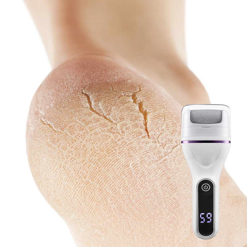 🏆50% de réduction pour une durée limitée✨🌸Extracteur de callosités électrique portatif pour les pieds